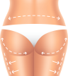 Liposuction - Yağ Enjeksiyonu