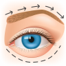 Eyelid Eyebrow Lift
